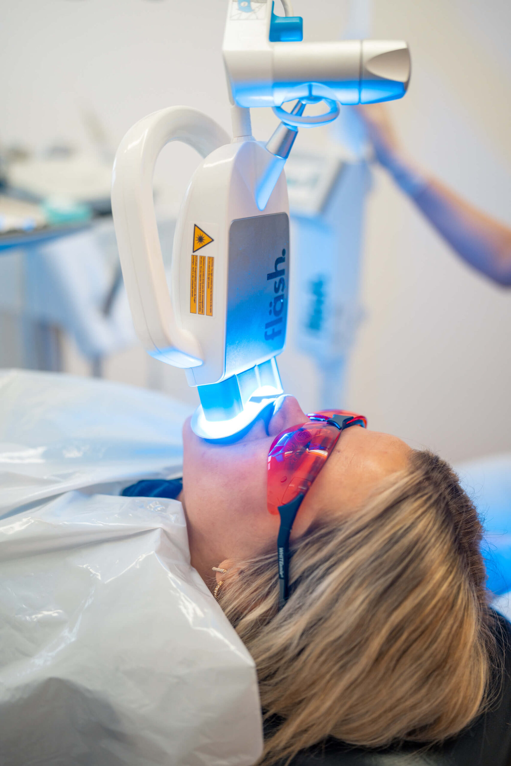 Zahnaufhellung in nur einer Sitzung mit Bleaching